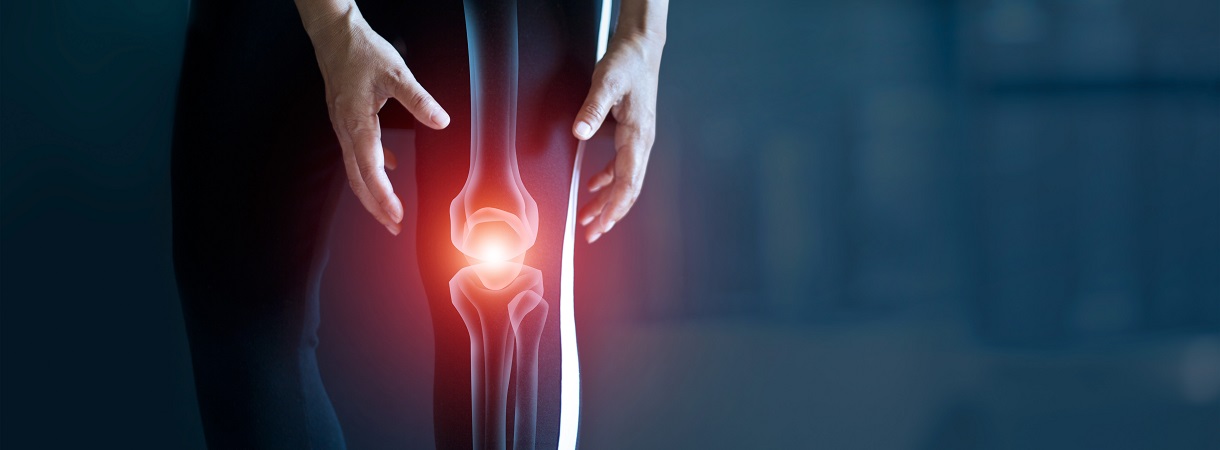 Woman,Suffering,From,Pain,In,Knee,,Injury,From,Workout,And