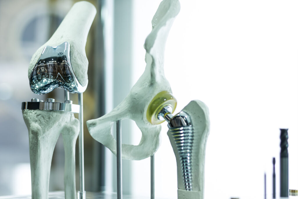 Post-op pain from Joint replacement in Palos Hills and Mokena, IL